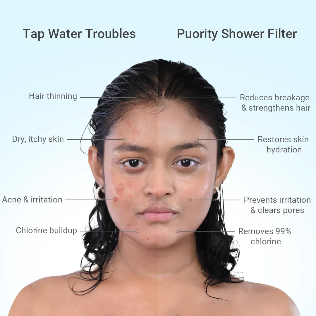Derma Flow Shower Filter