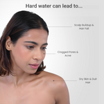 Load image into Gallery viewer, Derma Flow Shower Filter
